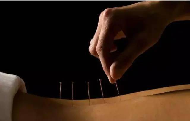 平衡針灸最新視頻，現(xiàn)代應(yīng)用探索針灸藝術(shù)的新境界